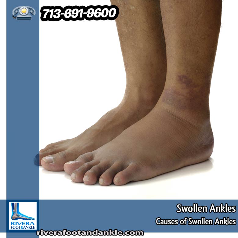 240116 Ankle and Foot Specialist Houston