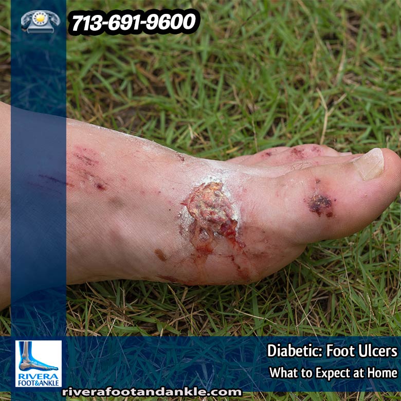 020316 Houston Foot Ankle Surgical