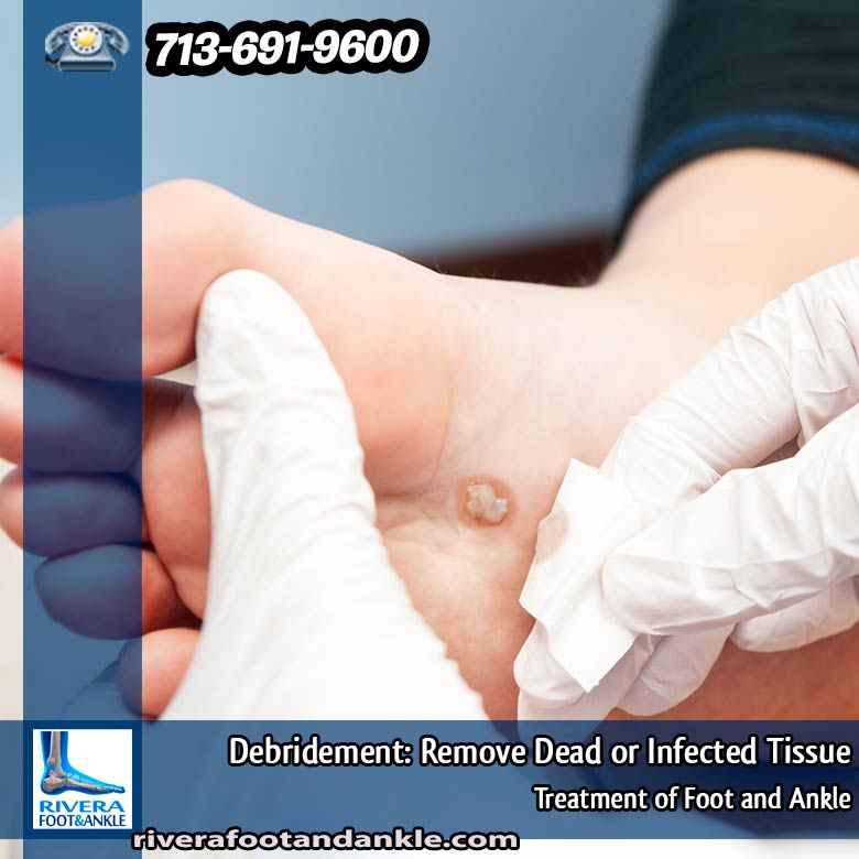 040316 Treatment of Foot and Ankle
