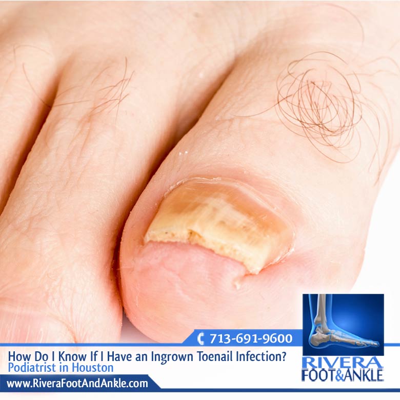 080416 Podiatrist in houston