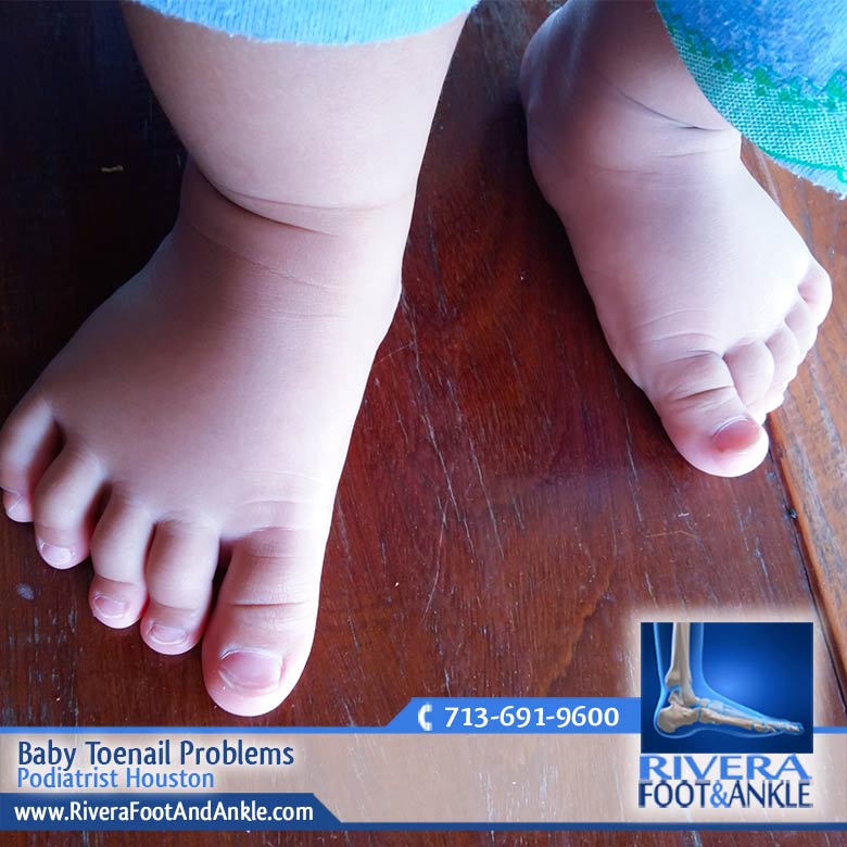 180416 Podiatrist Houston