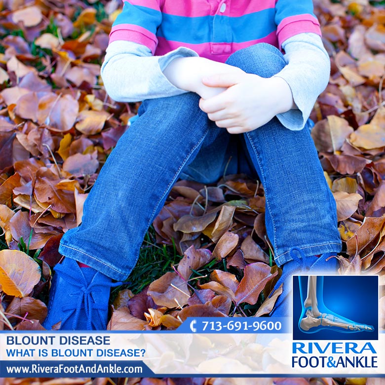 120916 Advanced Foot and Ankle Specialist in Houston