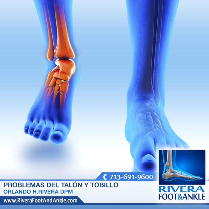 170916 Medico Especialista en Pie y Tobillo