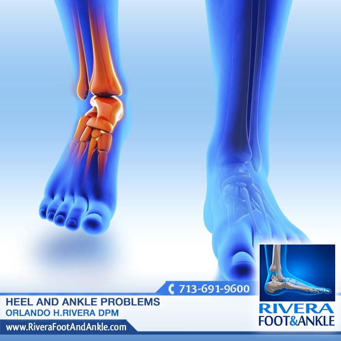 180916 Foot and Ankle Surgery in Houston