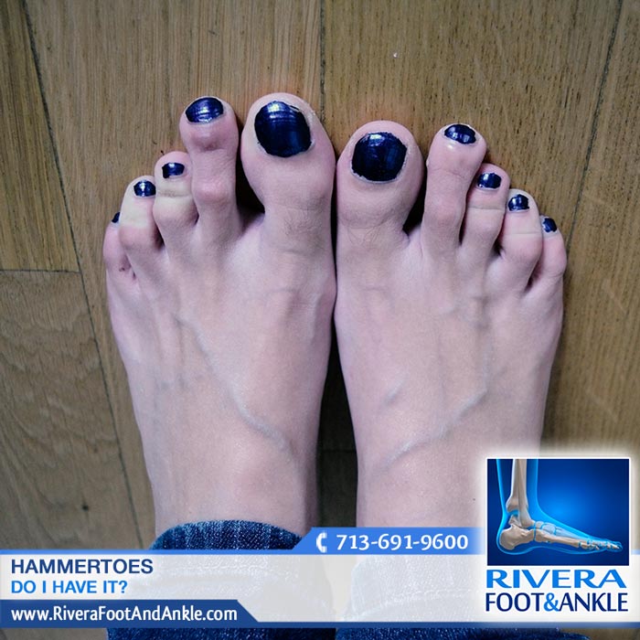 260916 best foot doctor in houston