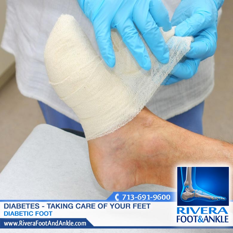 280916 diabetic foot doctor in houston