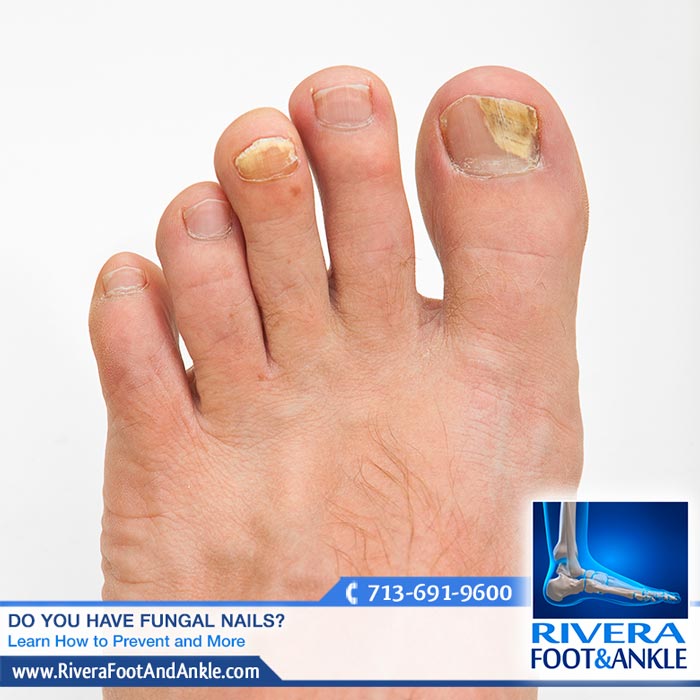 291016 Houston Foot and Ankle Surgery