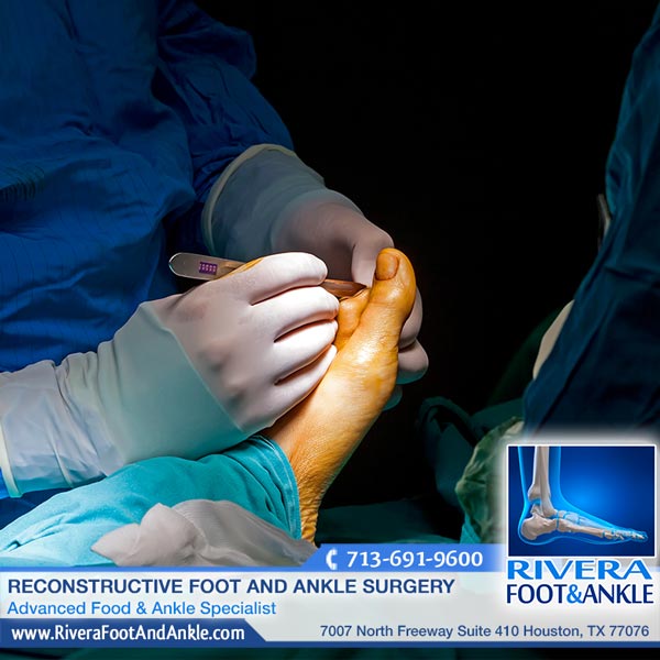 051116 foot and ankle surgery in houston