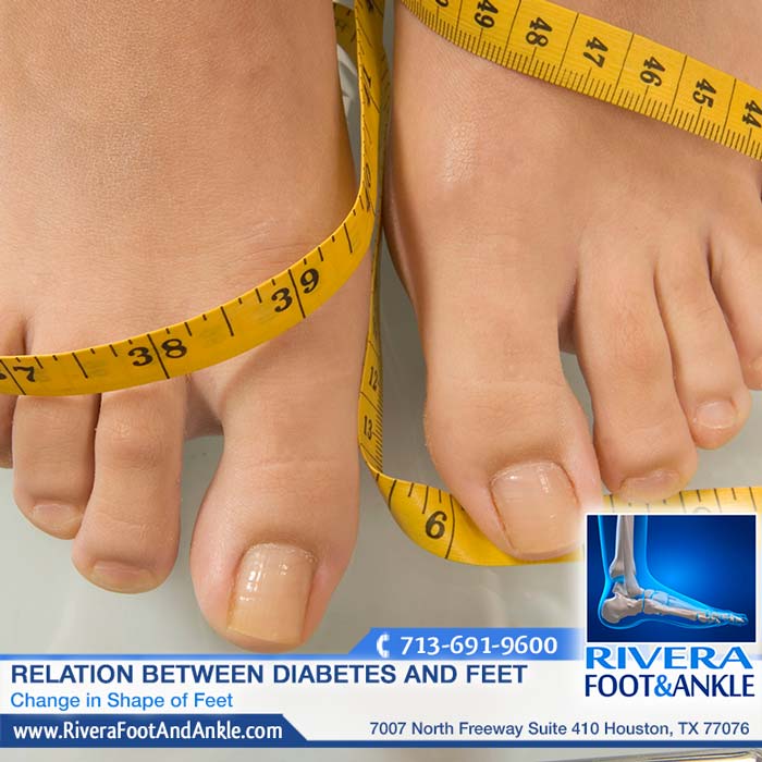131216 Houston Podiatrist