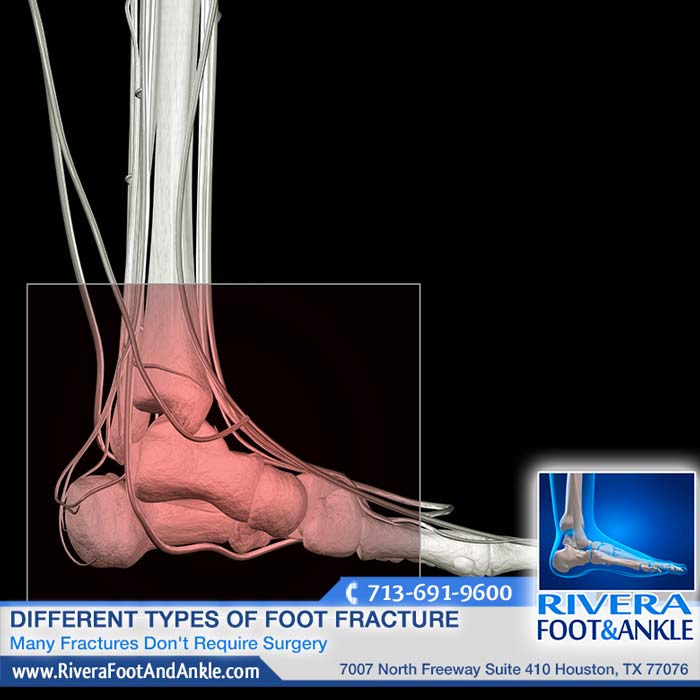 231216 Best Foot Doctor in Houston