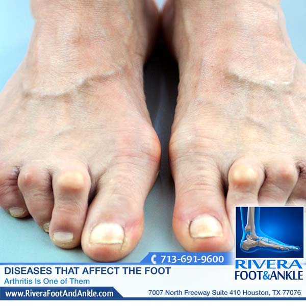 010317 podiatrist in houston