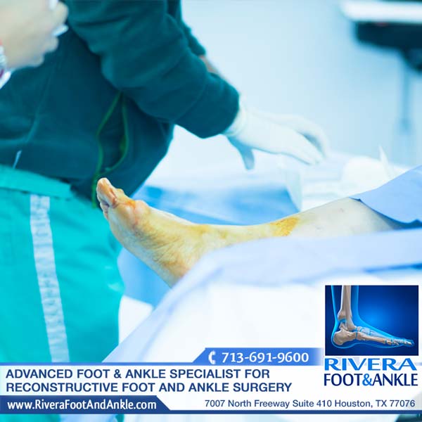010517 Foot and ankle doctor in houston