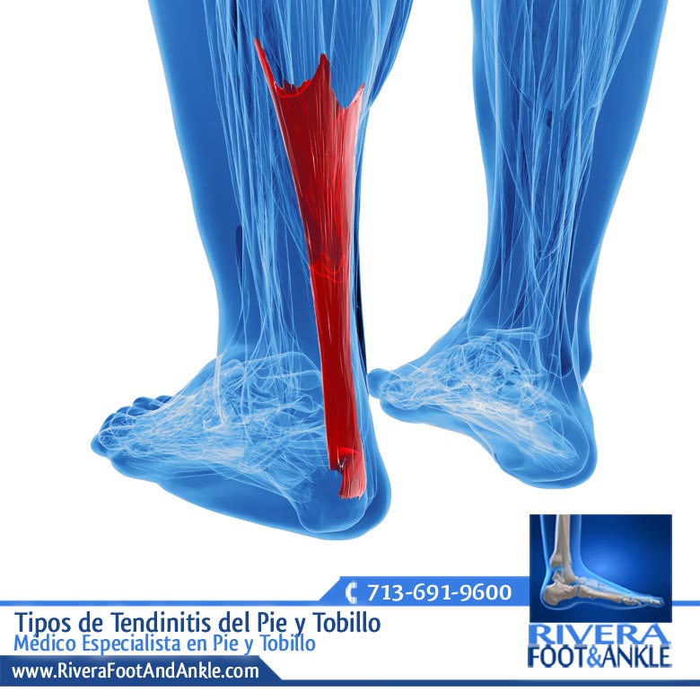 17 Medico Especialista en Pie y Tobillo