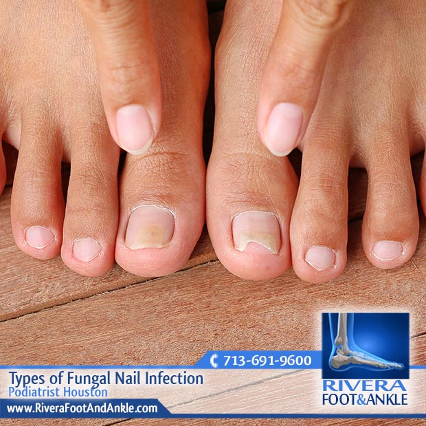 26 Podiatrist Houston