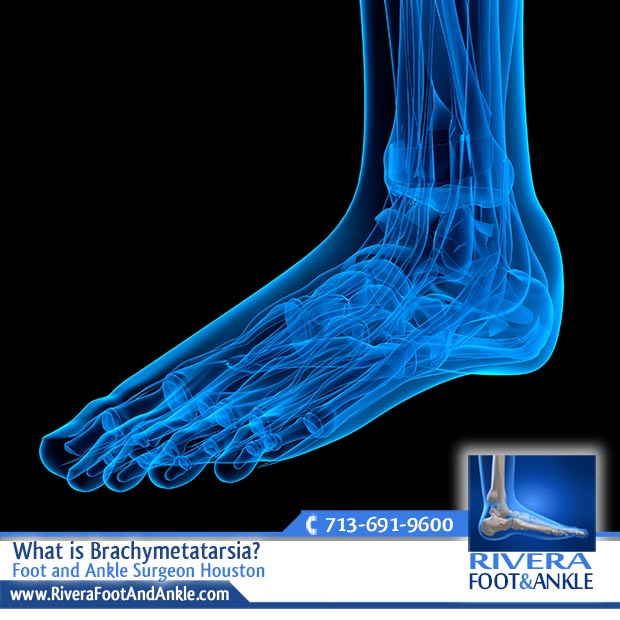 02 Foot and Ankle Surgeon Houston