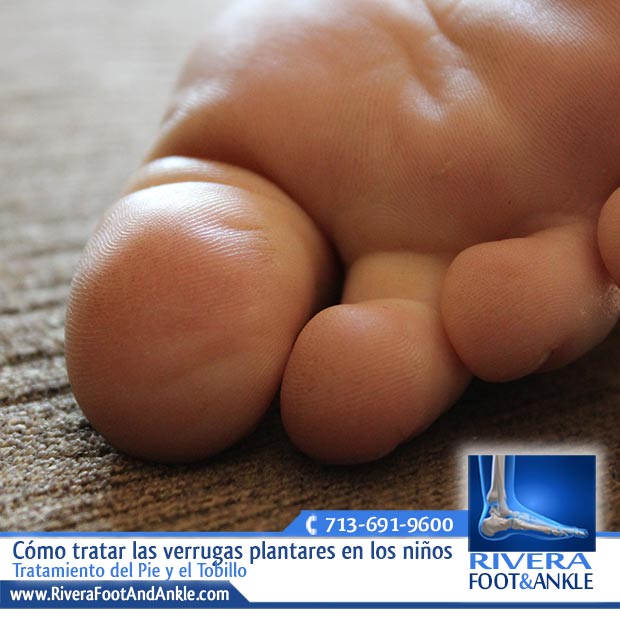 25 Tratamiento del Pie y el Tobillo