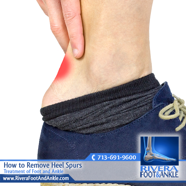 18 Treatment of Foot and Ankle