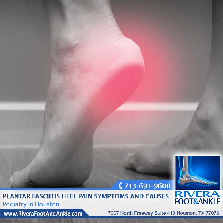 050118 Plantar Fasciitis doctor in Houston