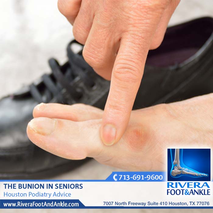 020318 Houston Podiatry Bunions