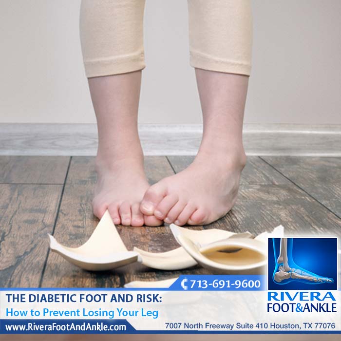 280318 diabetic foot specialist in houston
