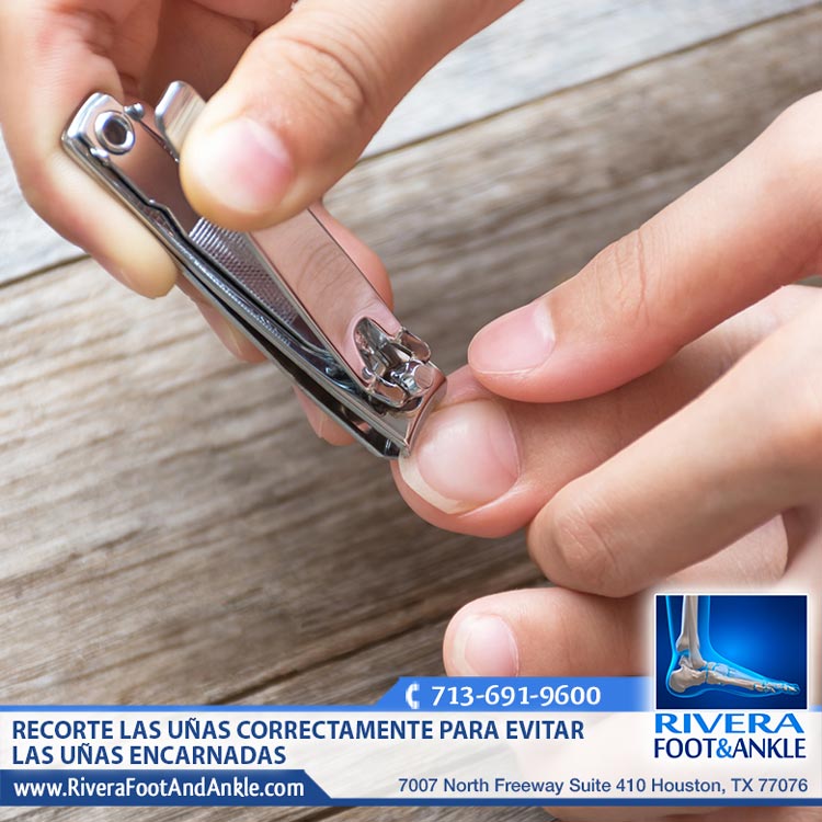 280118 Especialista en Unas Encarnadas en Houston