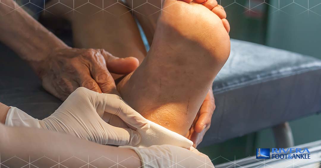 02 Tips for Diabetes Foot Care