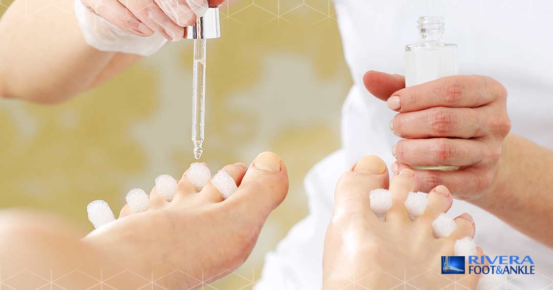 26 Five Natural Remedies for Athletes Foot