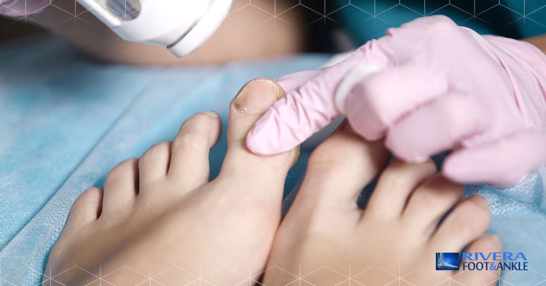 02 Types of Fungal Infections
