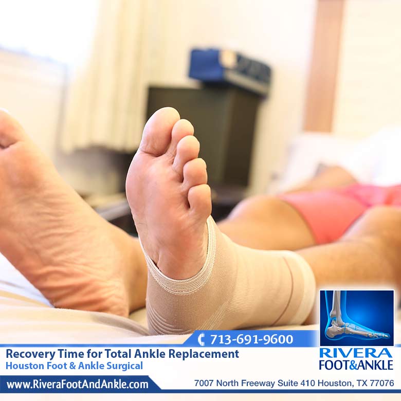 08 Recovery Time for Total Ankle Replacement