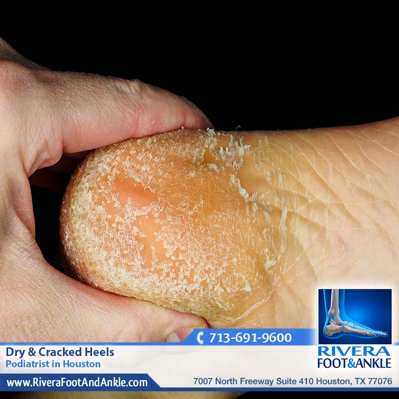 02 Podiatrist in Houston