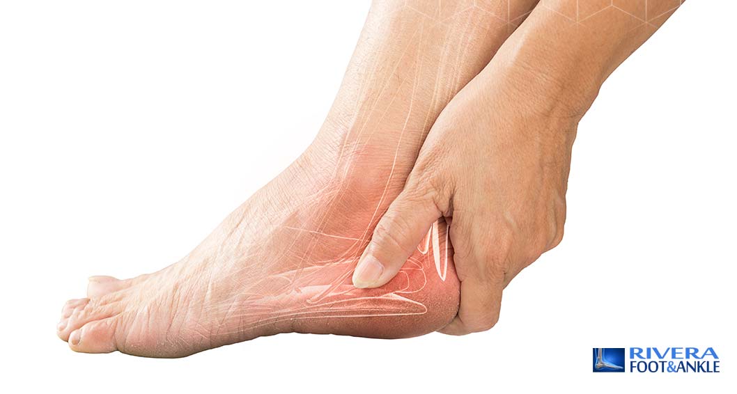02 Achilles Tendinitis