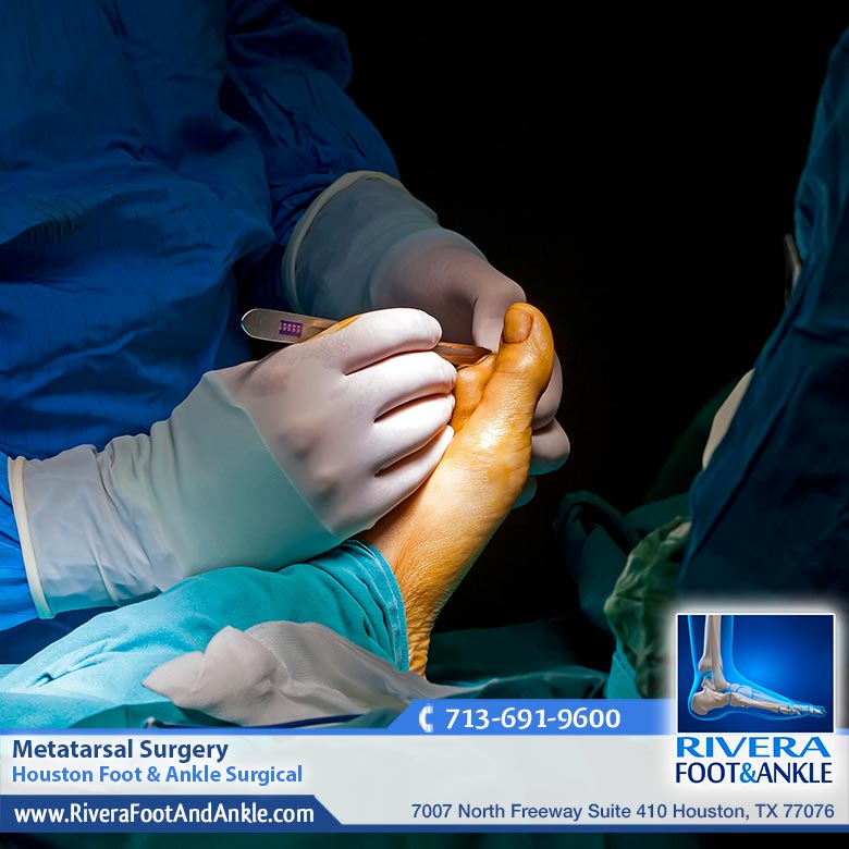12 Metatarsal Surgery