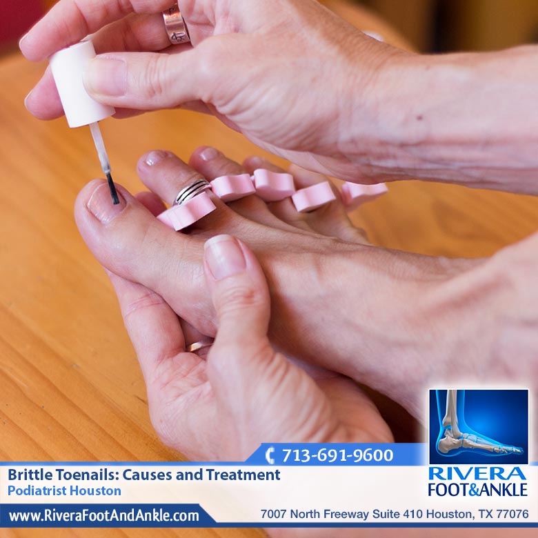 28 Brittle Toenails