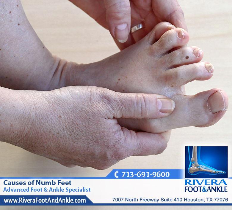 28 Causes of Numb Feet