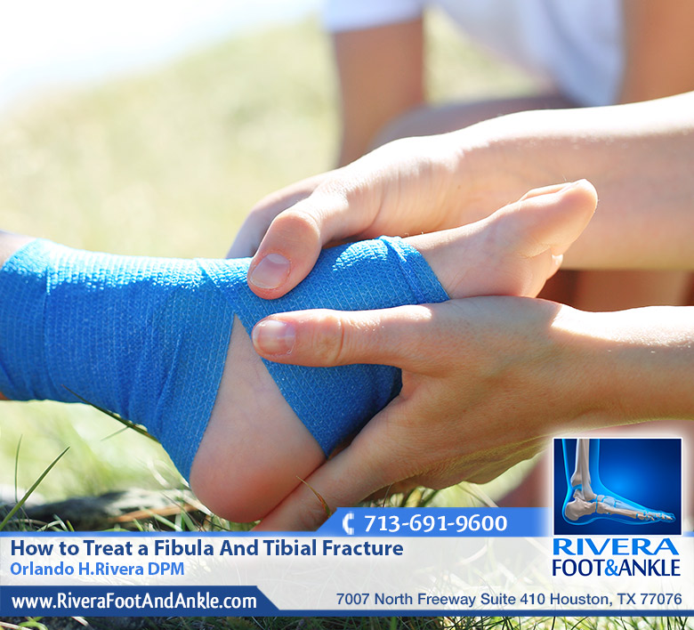 12 Fibula And Tibial Fracture