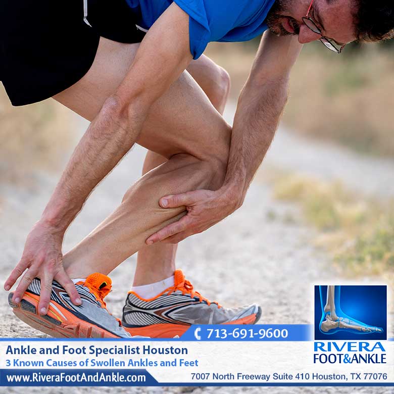 28. 3 Known Causes of Swollen Ankles and Feet