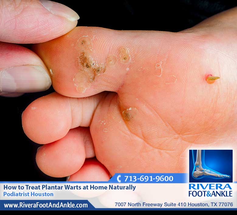 08 Podiatrist Houston