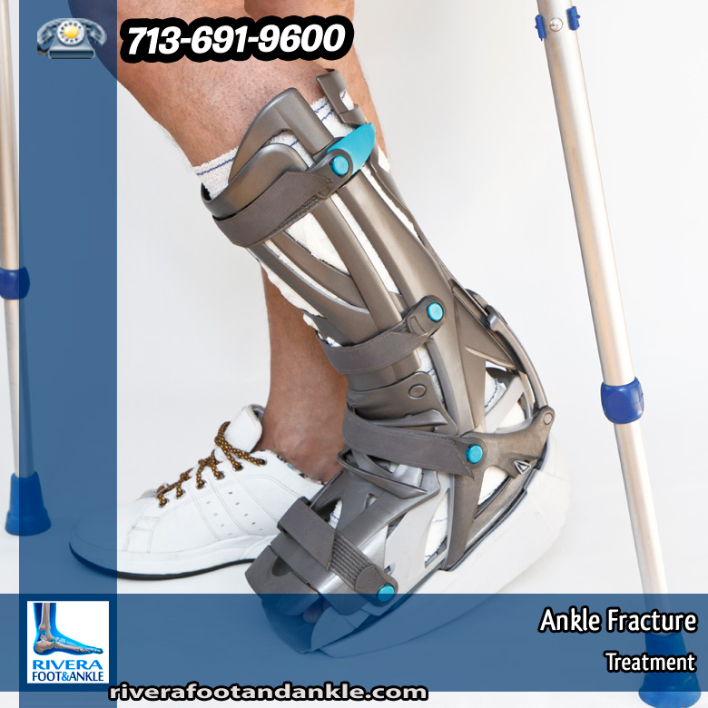 08-ankle-fracture-2014