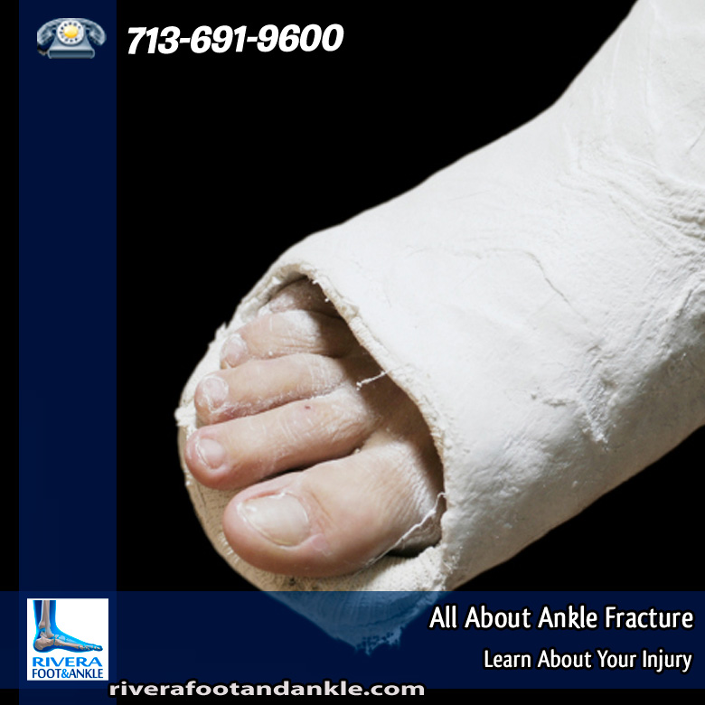 18-all-about-ankle-fracture-2014
