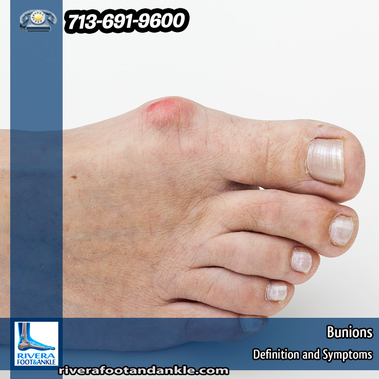 01-Bunions