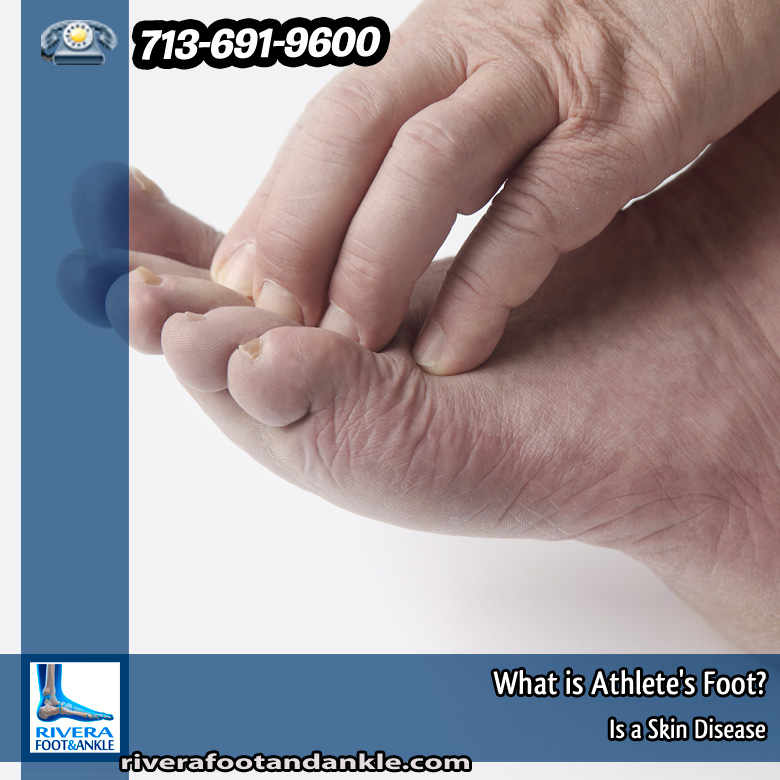 19-what-is-athlete-foot