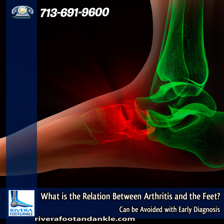 23-what-is-the-relation-between-arthritis-and-the-feet