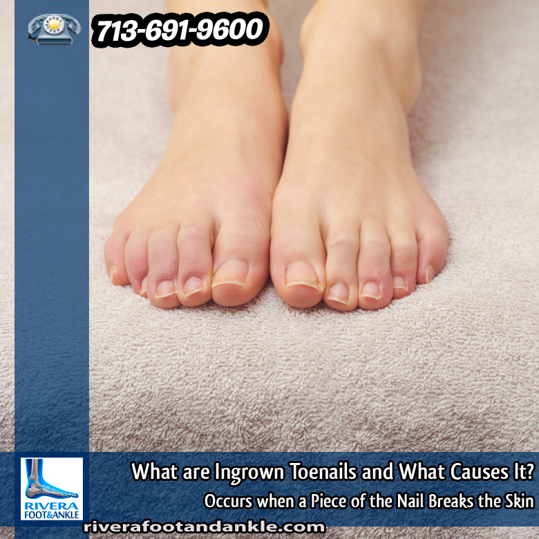 01-what-are-ingrown-toenails-and-what-causes-it