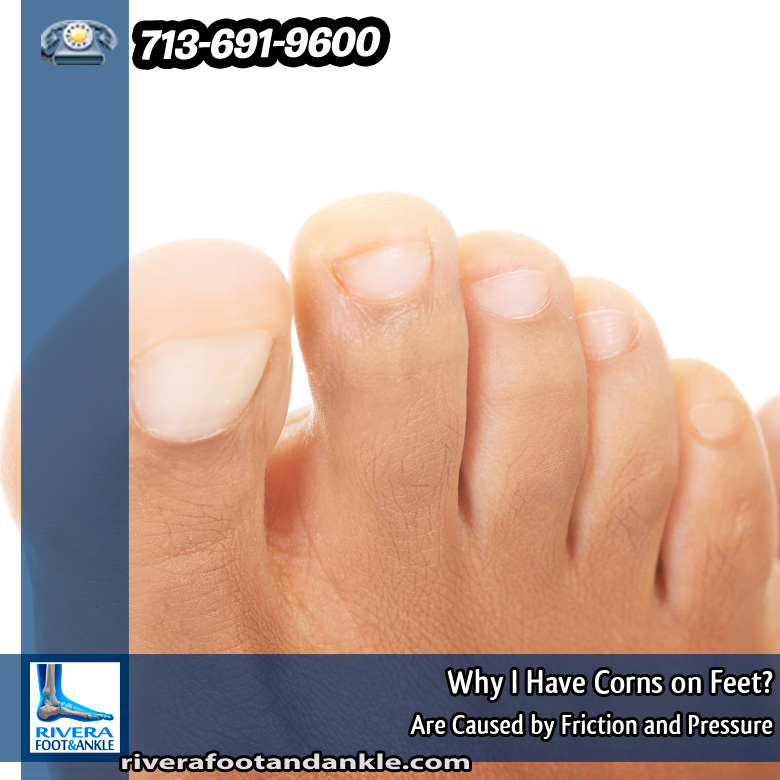 05-why-i-have-corns-on-feet