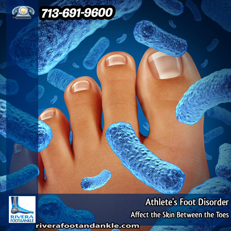 21-athletes-foot-disorder