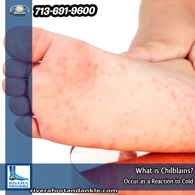 25-what-is-chilblains