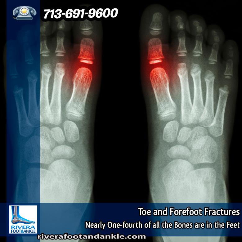 31-toe-and-forefoot-fractures