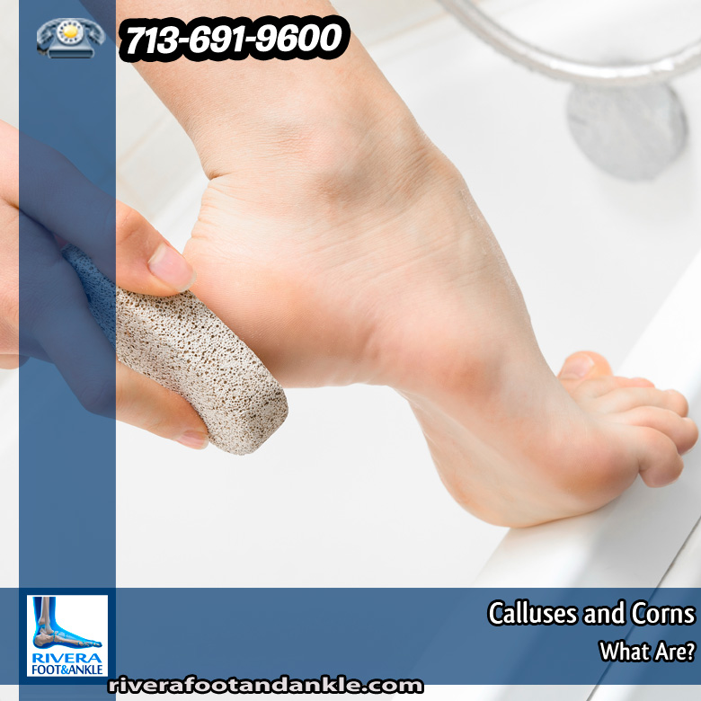 11-calluses-and-corns