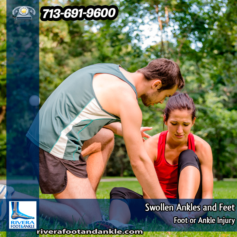 19-swollen-ankles-and-feet