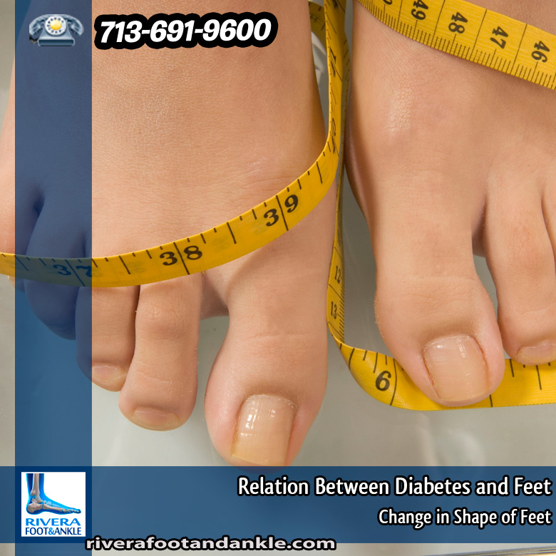 11-relation-between-diabetes-and-feet
